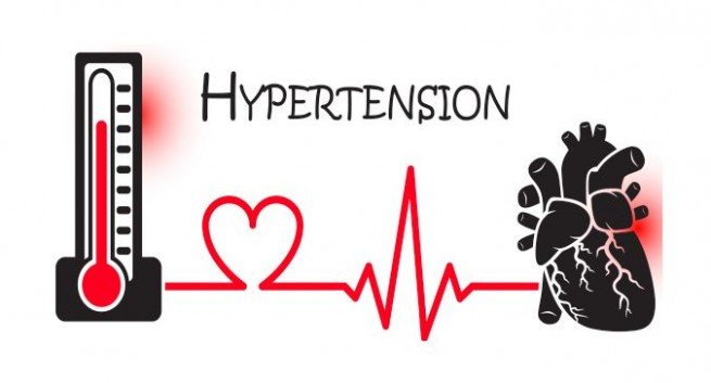 Hypertension: Experts advocate strengthening PHCs to curb fatalities